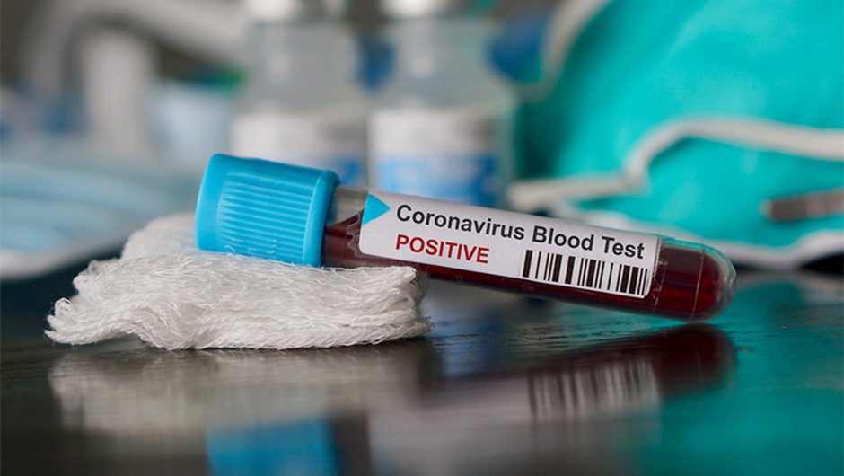 Coronavirus vaccine enters human testing trial