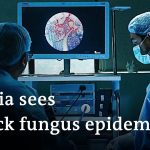 Why the deadly black fungus is ravaging COVID patients in India | DW News
