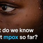 EU says further mpox cases are likely to be found soon in Europe | DW Analysis