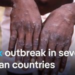WHO declares global public health emergency following Mpox outbreak | DW News